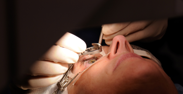 Apakah LASIK Bisa Dilakukan Sampai 2 Kali? Apa Penyebabnya