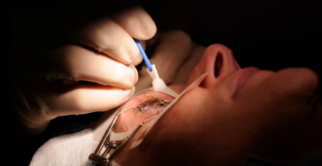 kacamata setelah operasi lasik