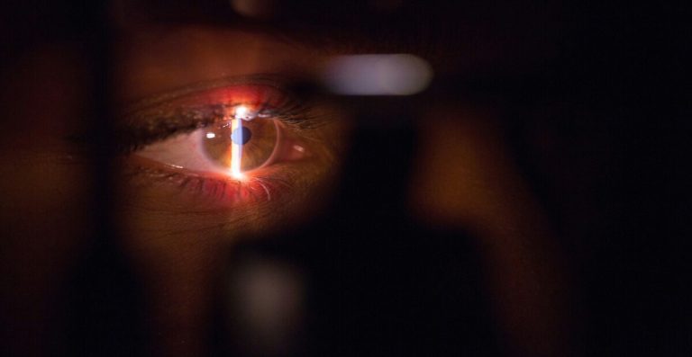 Tingkat Keberhasilan Operasi LASIK, Benarkah Bisa Gagal?